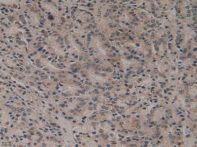 Polyclonal Antibody to FMS Like Tyrosine Kinase 3 (Flt3)