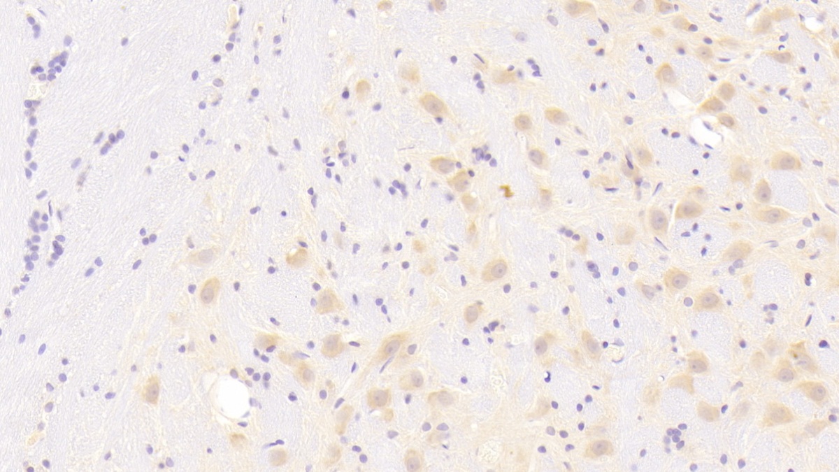 Polyclonal Antibody to Chemokine (C-X-C Motif) Ligand 1 (CXCL1)