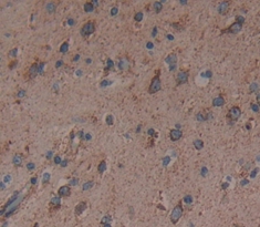 Polyclonal Antibody to Colony Stimulating Factor 3, Granulocyte (GCSF)