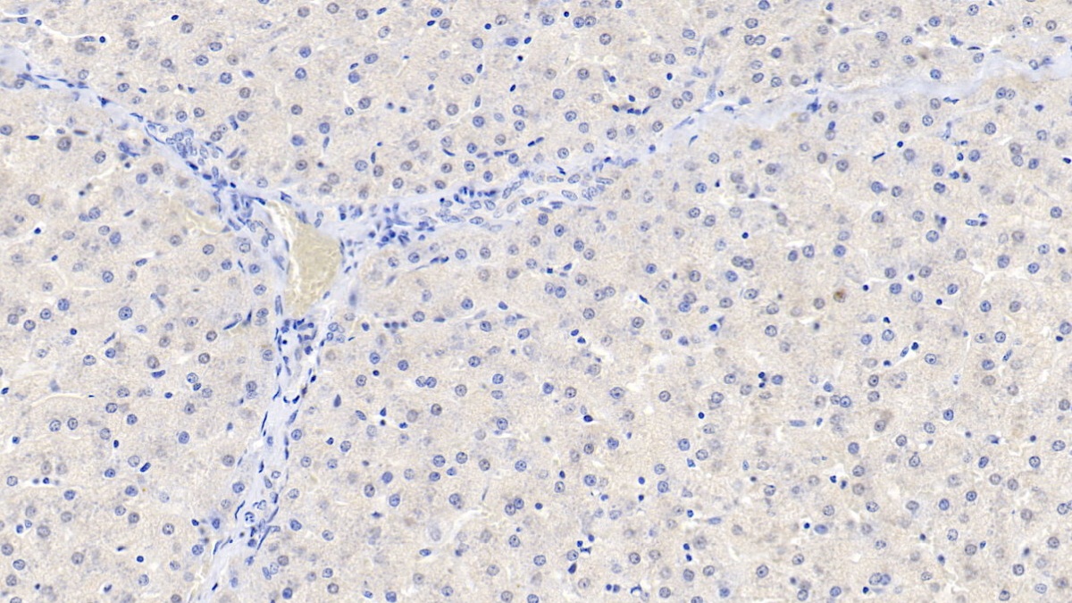 Polyclonal Antibody to Glial Cell Line Derived Neurotrophic Factor (GDNF)