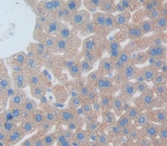 Polyclonal Antibody to Growth Hormone (GH)