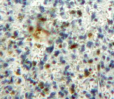 Polyclonal Antibody to Colony Stimulating Factor 2, Granulocyte Macrophage (GM-CSF)