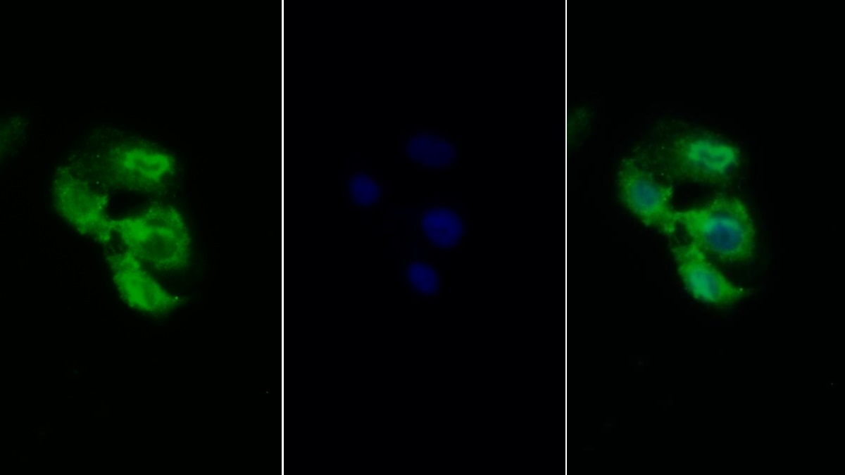 Polyclonal Antibody to Glycoprotein 130 (gp130)