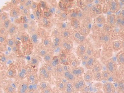 Polyclonal Antibody to Glycoprotein 130 (gp130)