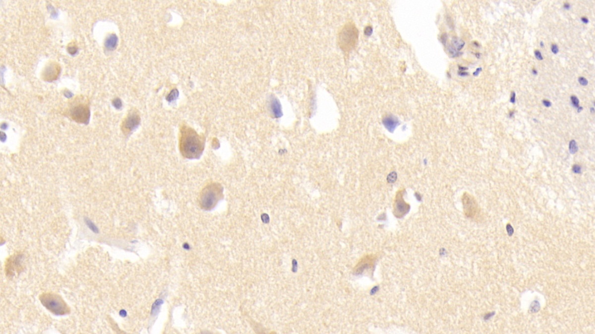 Polyclonal Antibody to Hepatocyte Growth Factor (HGF)