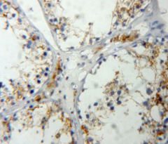 Polyclonal Antibody to Insulin Like Growth Factor 2 (IGF2)