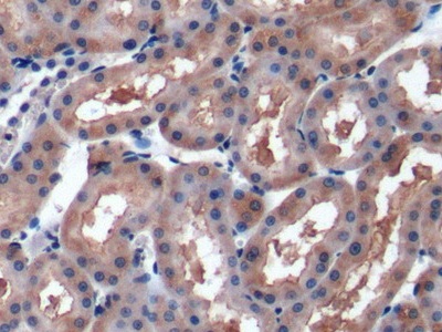 Polyclonal Antibody to Insulin Like Growth Factor 2 (IGF2)