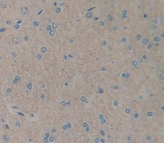 Polyclonal Antibody to Interleukin 1 Receptor Type I (IL1R1)