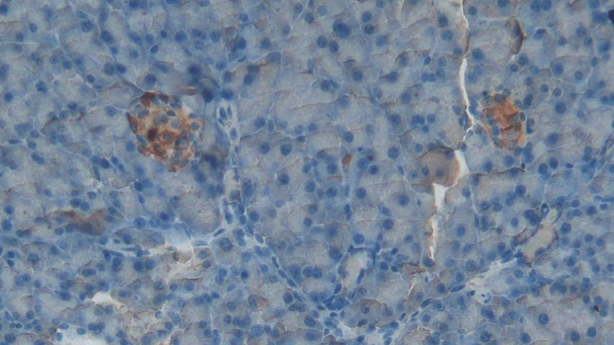 Polyclonal Antibody to Glial Fibrillary Acidic Protein (GFAP)