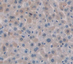 Polyclonal Antibody to Meningioma Expressed Antigen 5 (MGEA5)