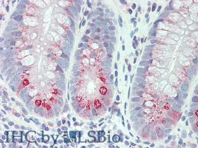 Polyclonal Antibody to Interleukin 3 (IL3)