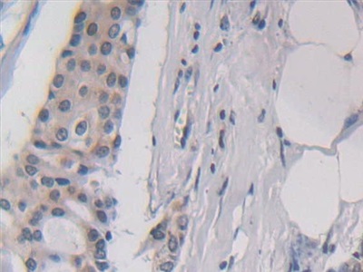 Polyclonal Antibody to Interleukin 5 (IL5)