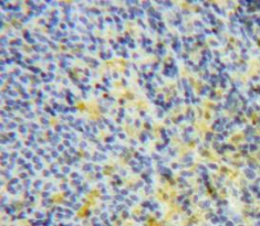 Polyclonal Antibody to Interleukin 6 (IL6)