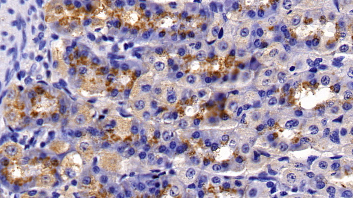 Polyclonal Antibody to Leptin (LEP)