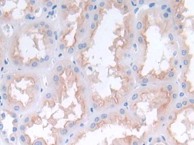 Polyclonal Antibody to Monocyte Chemotactic Protein 2 (MCP2)