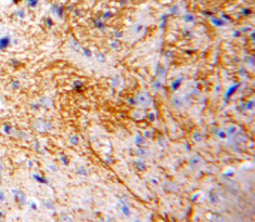 Polyclonal Antibody to Monocyte Chemotactic Protein 3 (MCP3)