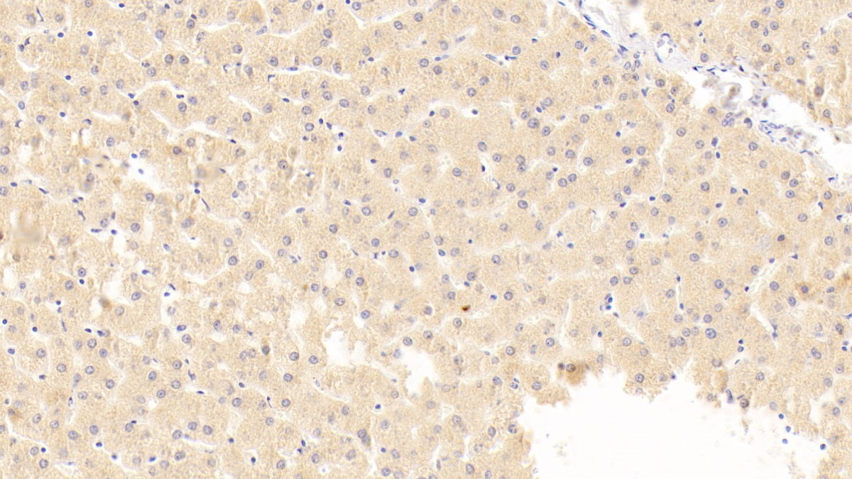 Polyclonal Antibody to Macrophage Inflammatory Protein 1 Beta (MIP1b)