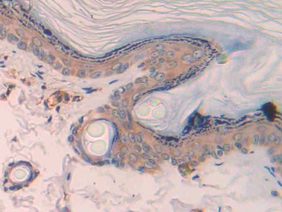 Polyclonal Antibody to Macrophage Inflammatory Protein 1 Beta (MIP1b)