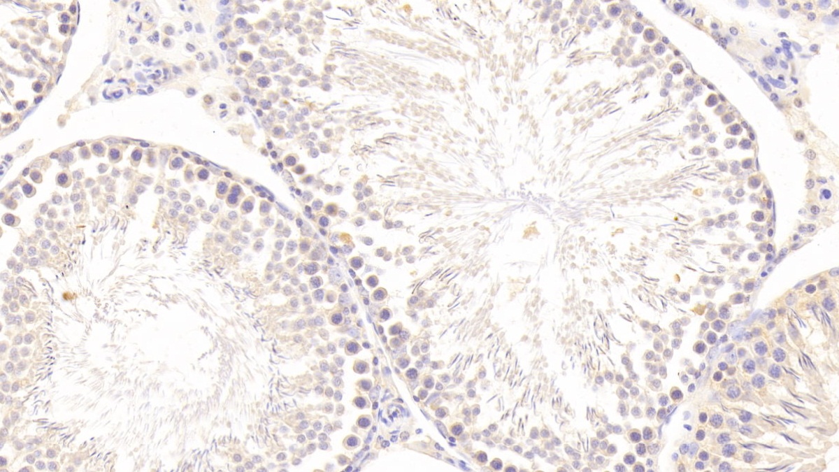 Polyclonal Antibody to Matrix Metalloproteinase 1 (MMP1)