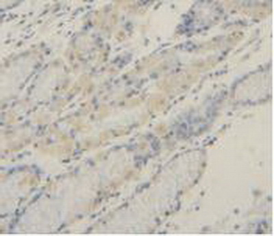 Polyclonal Antibody to Matrix Metalloproteinase 2 (MMP2)