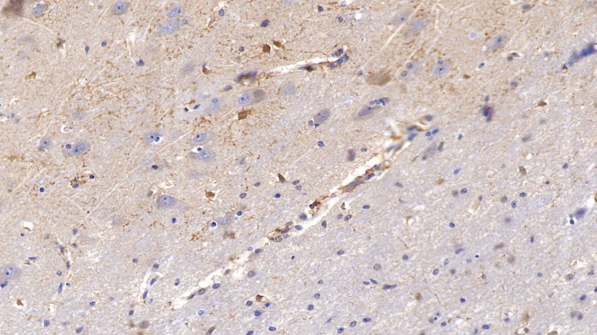 Polyclonal Antibody to Matrix Metalloproteinase 2 (MMP2)