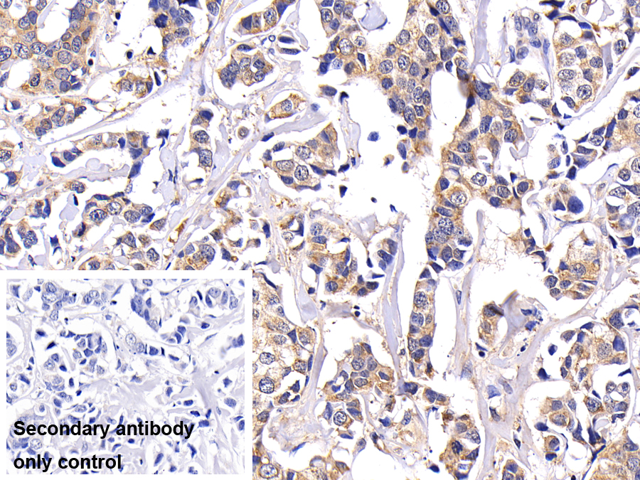 Polyclonal Antibody to Matrix Metalloproteinase 7 (MMP7)