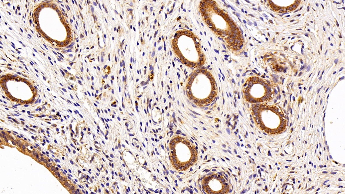 Polyclonal Antibody to Matrix Metalloproteinase 7 (MMP7)