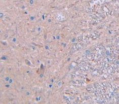 Polyclonal Antibody to Creatine Kinase, Muscle (CKM)