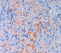 Polyclonal Antibody to Oncostatin M (OSM)