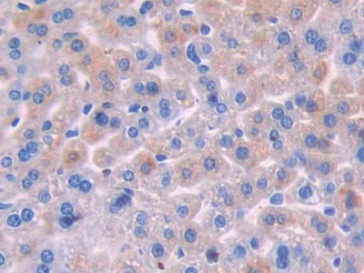 Polyclonal Antibody to Oncostatin M (OSM)