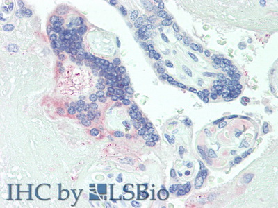 Polyclonal Antibody to Placenta Growth Factor (PLGF)