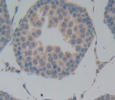 Polyclonal Antibody to Superoxide Dismutase 3, Extracellular (SOD3)