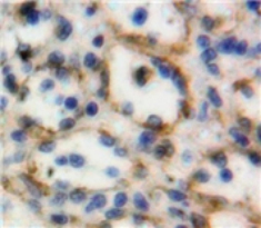 Polyclonal Antibody to Cluster Of Differentiation 30 Ligand (CD30L)