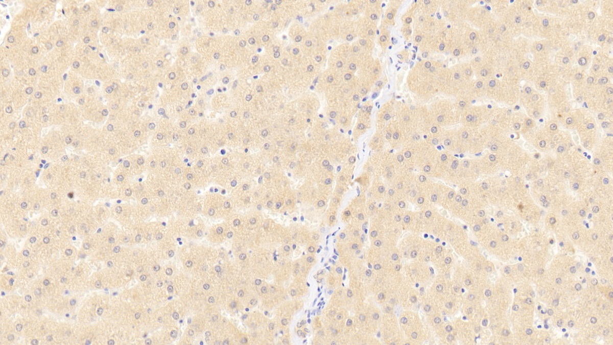 Polyclonal Antibody to Cluster Of Differentiation 40 Ligand (CD40L)