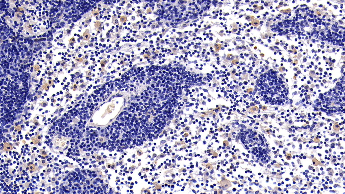 Polyclonal Antibody to Cluster Of Differentiation 40 Ligand (CD40L)