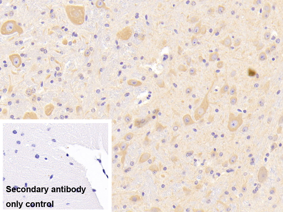 Polyclonal Antibody to Stem Cell Factor Receptor (SCFR)