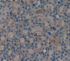 Polyclonal Antibody to Transforming Growth Factor Alpha (TGFa)