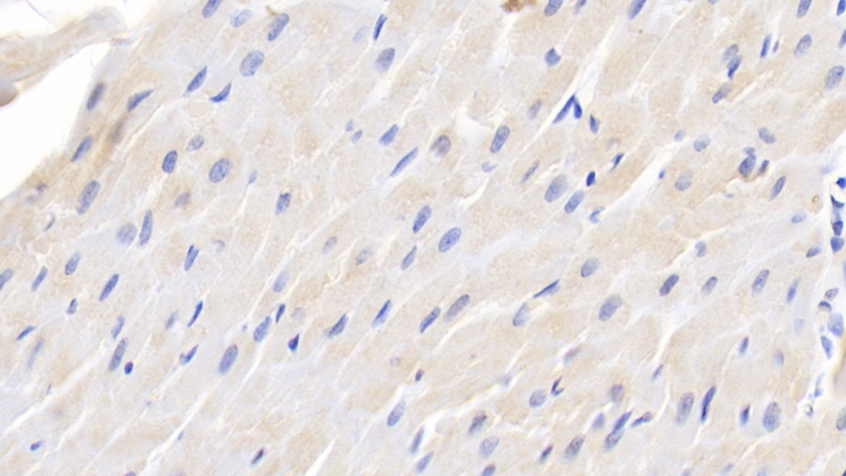 Polyclonal Antibody to Transforming Growth Factor Beta 1 (TGFb1)