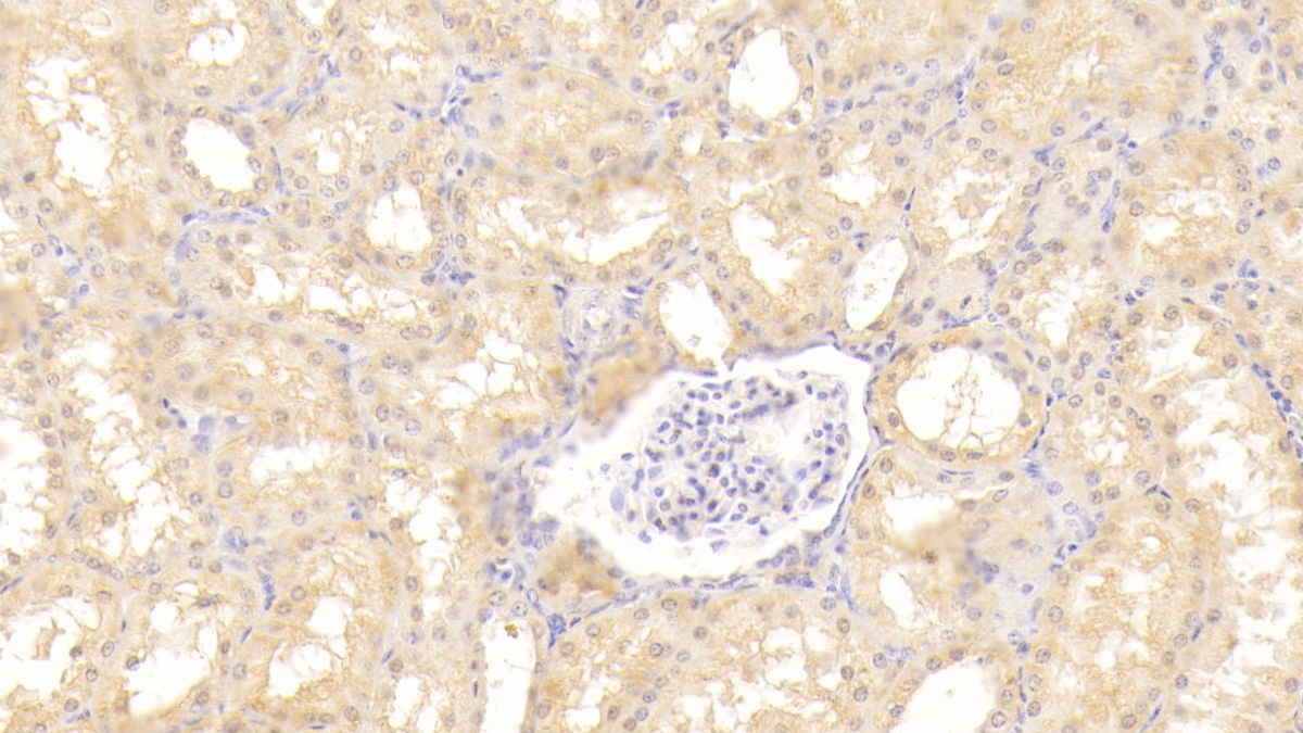 Polyclonal Antibody to Tyrosine Kinase With Immunoglobulin Like And EGF Like Domains Protein 1 (Tie1)