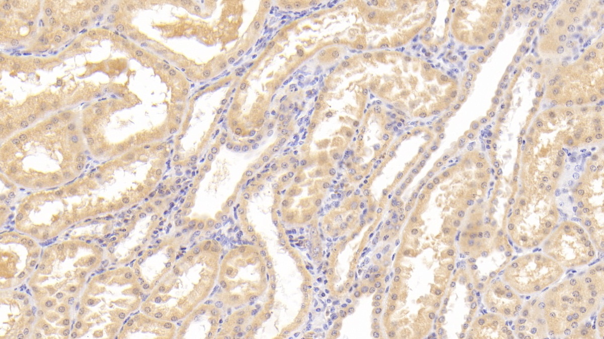 Polyclonal Antibody to Tyrosine Kinase With Immunoglobulin Like And EGF Like Domains Protein 1 (Tie1)