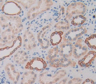 Polyclonal Antibody to Tyrosine Kinase With Immunoglobulin Like And EGF Like Domains Protein 1 (Tie1)