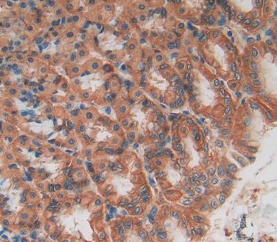 Polyclonal Antibody to TEK Tyrosine Kinase, Endothelial (Tie2)