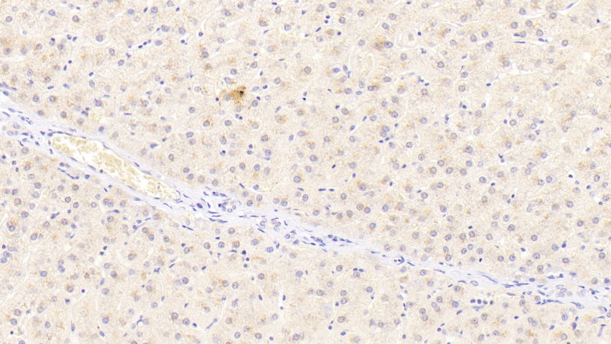 Polyclonal Antibody to Adiponectin Receptor 2 (ADIPOR2)