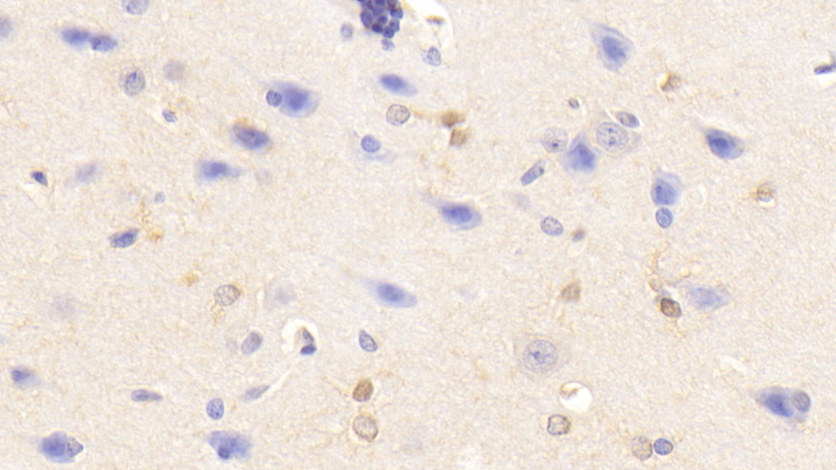 Polyclonal Antibody to Tumor Necrosis Factor Alpha (TNFa)