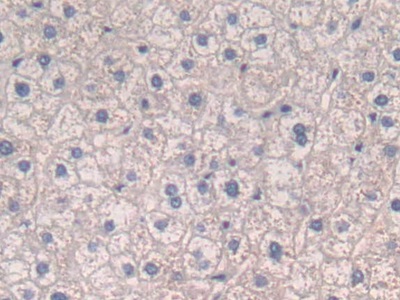 Polyclonal Antibody to Tumor Necrosis Factor Beta (TNFb)