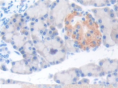 Polyclonal Antibody to Thrombopoietin (TPO)