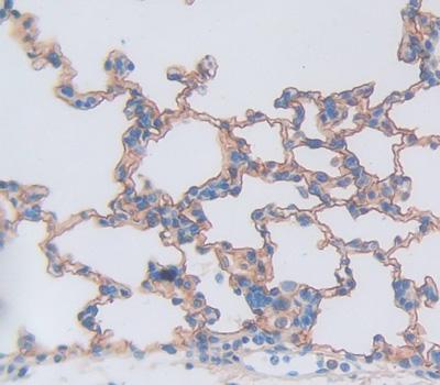 Polyclonal Antibody to Tumor Necrosis Factor Receptor Superfamily, Member 10C (TNFRSF10C)