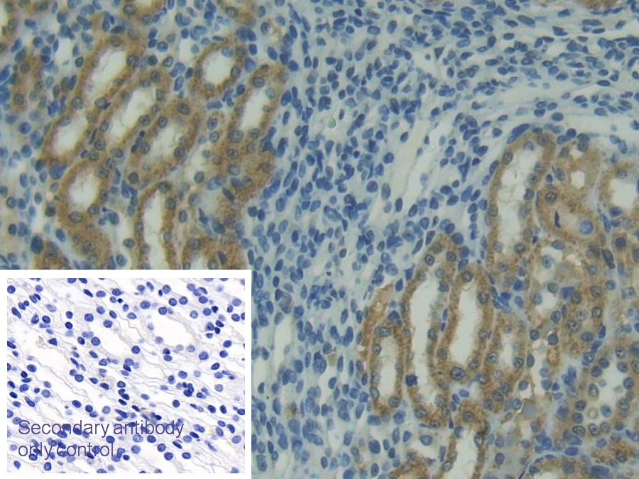 Polyclonal Antibody to Tumor Necrosis Factor Related Apoptosis Inducing Ligand (TRAIL)