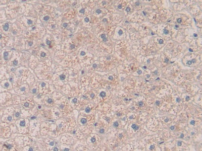 Polyclonal Antibody to Vascular Endothelial Growth Factor A (VEGFA)