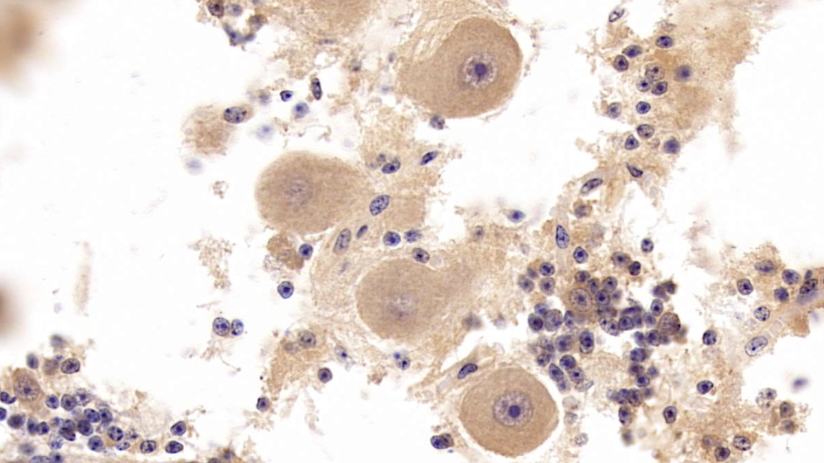 Polyclonal Antibody to Vascular Endothelial Growth Factor D (VEGFD)